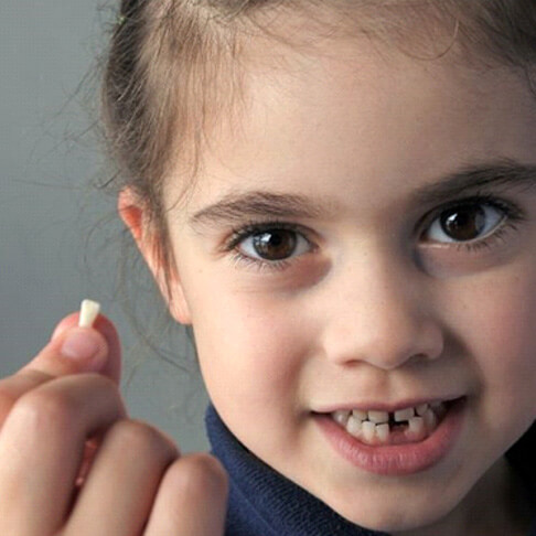 cute little girl holding her extracted tooth